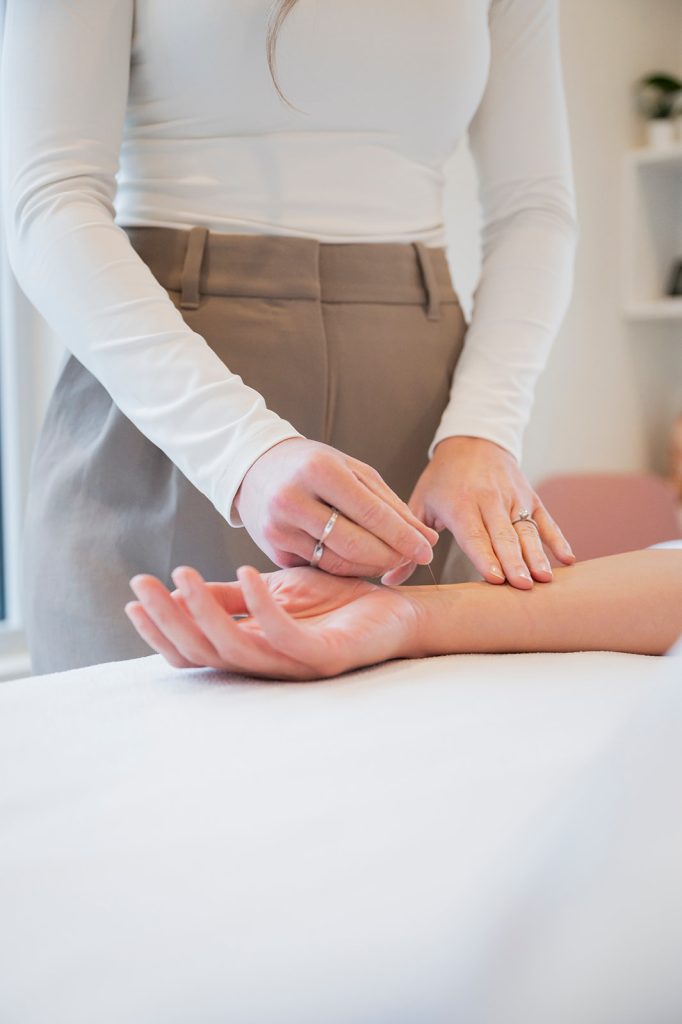 Acupuncture